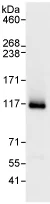 Immunoprecipitation - Anti-XPF antibody (AB76948)