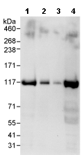 Western blot - Anti-XPF antibody (AB76948), expandable thumbnail