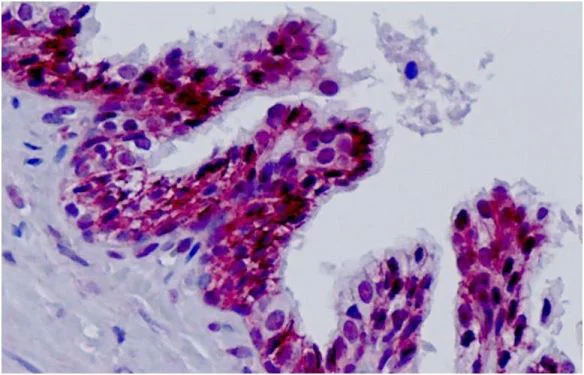 Immunohistochemistry (Formalin/PFA-fixed paraffin-embedded sections) - Anti-XPG antibody (AB189317)