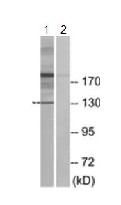Western blot - Anti-XPG antibody (AB189317)