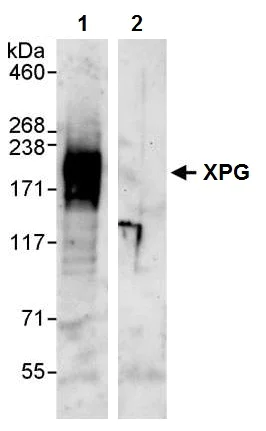 Immunoprecipitation - Anti-XPG antibody (AB224815)