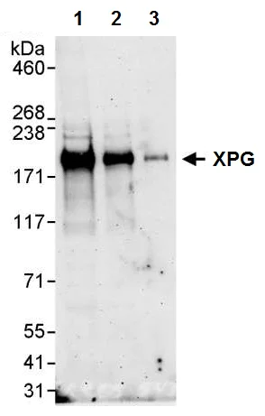 Western blot - Anti-XPG antibody (AB224815)