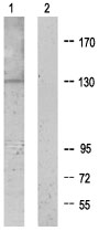 Western blot - Anti-XPG antibody (AB64931), expandable thumbnail