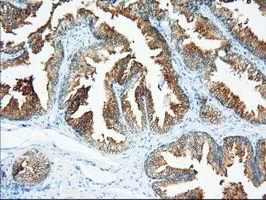 Immunohistochemistry (Formalin/PFA-fixed paraffin-embedded sections) - Anti-XPNPEP1 antibody [OTI1E3] (AB123929)