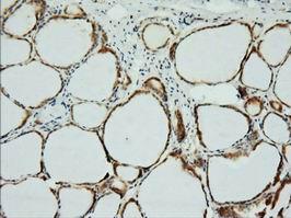 Immunohistochemistry (Formalin/PFA-fixed paraffin-embedded sections) - Anti-XPNPEP1 antibody [OTI1E3] (AB123929)