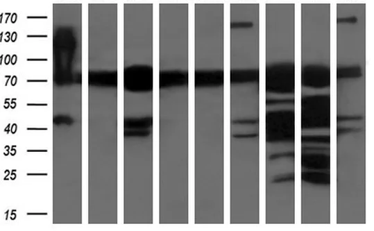 Western blot - Anti-XPNPEP1 antibody [OTI1E3] (AB123929)