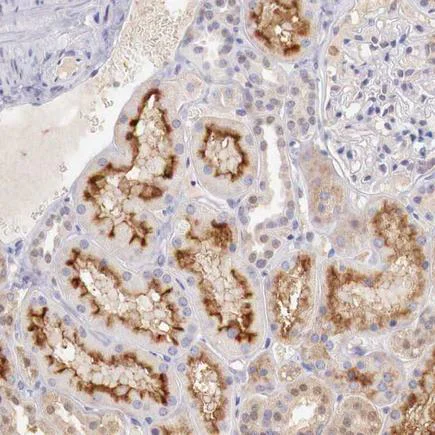 Immunohistochemistry (Formalin/PFA-fixed paraffin-embedded sections) - Anti-XPNPEP2/mAPP antibody (AB224034)