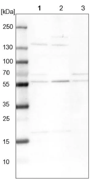 Western blot - Anti-XPNPEP3 antibody (AB224211)