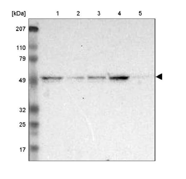 Western blot - Anti-XPNPEP3 antibody (AB224211)