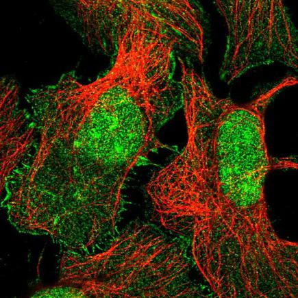 Immunocytochemistry/ Immunofluorescence - Anti-XPO6 antibody (AB243712)