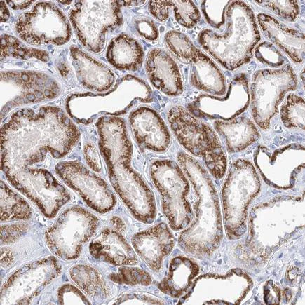 Immunohistochemistry (Formalin/PFA-fixed paraffin-embedded sections) - Anti-XPO6 antibody (AB243712)