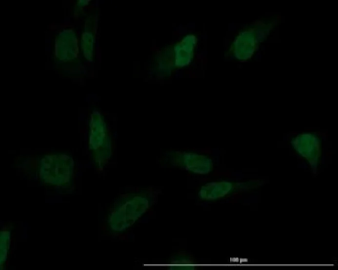 Immunocytochemistry/ Immunofluorescence - Anti-XRCC1 antibody (AB235196)