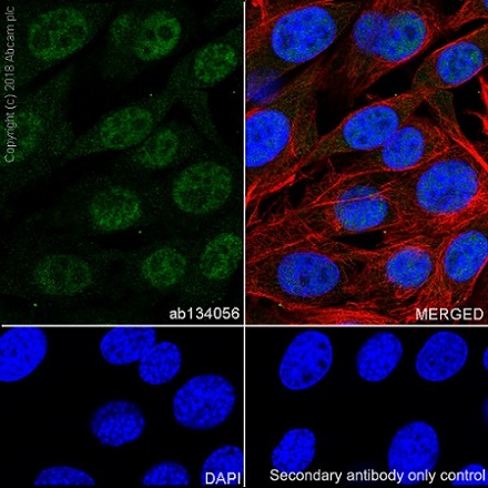 Immunocytochemistry/ Immunofluorescence - Anti-XRCC1 antibody [EPR4389(2)] (AB134056), expandable thumbnail