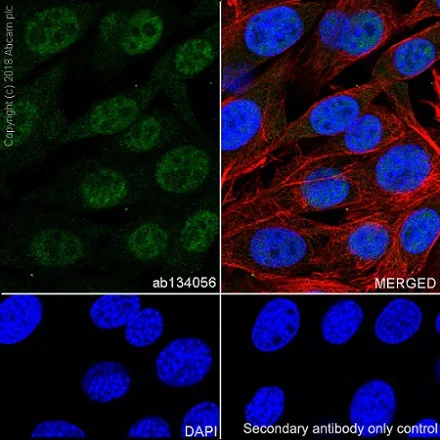 Immunocytochemistry/ Immunofluorescence - Anti-XRCC1 antibody [EPR4389(2)] (AB134056)