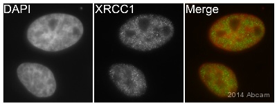 Immunocytochemistry/ Immunofluorescence - Anti-XRCC1 antibody [EPR4389(2)] (ab134056), expandable thumbnail