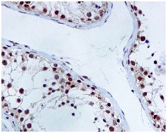 Immunohistochemistry (Formalin/PFA-fixed paraffin-embedded sections) - Anti-XRCC1 antibody [EPR4389(2)] (AB134056), expandable thumbnail