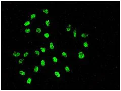 Immunocytochemistry/ Immunofluorescence - Anti-XRCC1 antibody [EPR4389(2)] - BSA and Azide free (AB226150)