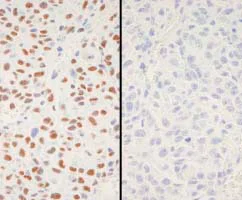 Immunohistochemistry (Formalin/PFA-fixed paraffin-embedded sections) - Anti-XRCC1 (phospho S518 + T519 + T523) antibody (AB84417)