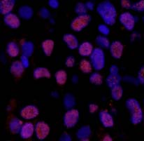 Immunohistochemistry (Formalin/PFA-fixed paraffin-embedded sections) - Anti-XRCC1 (phospho S518 + T519 + T523) antibody (AB84417)