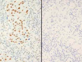 Immunohistochemistry (Formalin/PFA-fixed paraffin-embedded sections) - Anti-XRCC1 (phospho S518 + T519 + T523) antibody (AB84417)