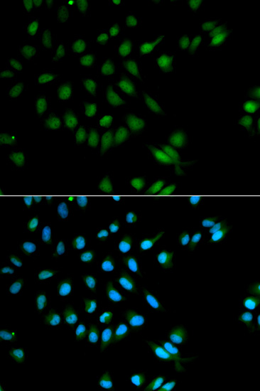 Immunocytochemistry/ Immunofluorescence - Anti-XRCC2 antibody (AB180752)