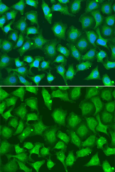 Immunocytochemistry/ Immunofluorescence - Anti-XRCC2 antibody (AB180752)
