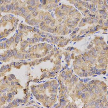 Immunohistochemistry (Formalin/PFA-fixed paraffin-embedded sections) - Anti-XRCC2 antibody (AB180752)