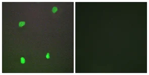 Immunocytochemistry/ Immunofluorescence - Anti-XRCC3 antibody (AB58467)