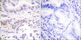 Immunohistochemistry (Formalin/PFA-fixed paraffin-embedded sections) - Anti-XRCC3 antibody (AB58467)