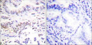 Immunohistochemistry (Formalin/PFA-fixed paraffin-embedded sections) - Anti-XRCC3 antibody (AB58467)