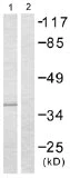 Western blot - Anti-XRCC3 antibody (AB58467)