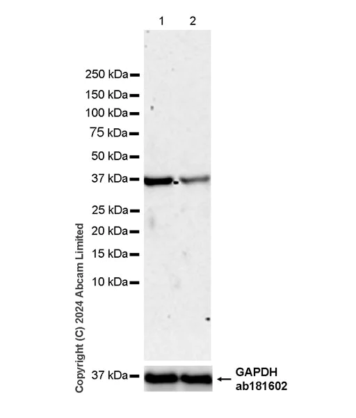 Western blot - Anti-XRCC3 antibody [EPR28957-35] (AB321986)