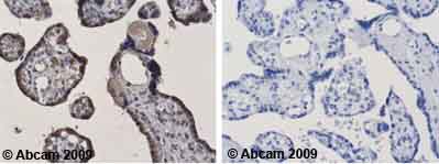 Immunohistochemistry (Formalin/PFA-fixed paraffin-embedded sections) - Anti-XRCC3 antibody [XRCC3 10F1/6] (AB20254)