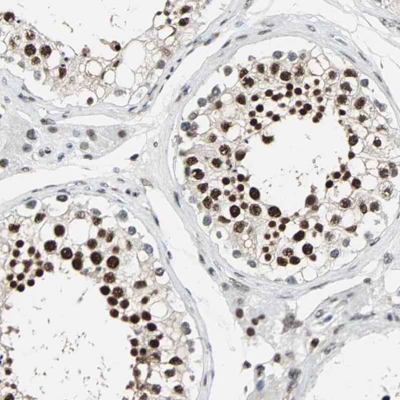 Immunohistochemistry (Formalin/PFA-fixed paraffin-embedded sections) - Anti-XRCC4 antibody (AB213729)