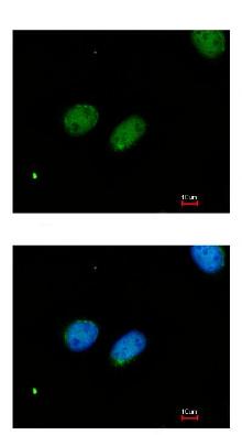 Immunocytochemistry/ Immunofluorescence - Anti-XRCC4 antibody (AB97351), expandable thumbnail