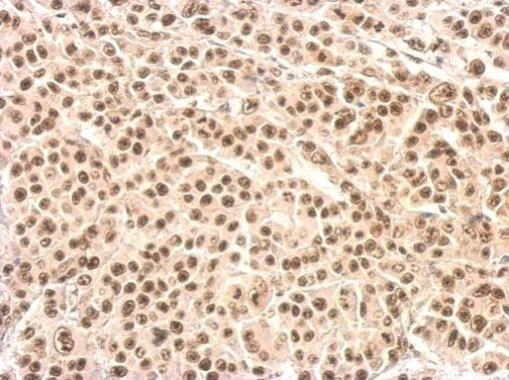 Immunohistochemistry (Formalin/PFA-fixed paraffin-embedded sections) - Anti-XRCC4 antibody (AB97351)