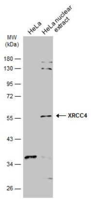 Western blot - Anti-XRCC4 antibody (AB97351), expandable thumbnail