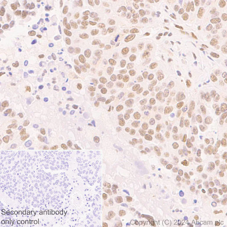 Immunohistochemistry (Formalin/PFA-fixed paraffin-embedded sections) - Anti-XRCC4 antibody [EPR28958-63] - BSA and Azide free (AB317698)