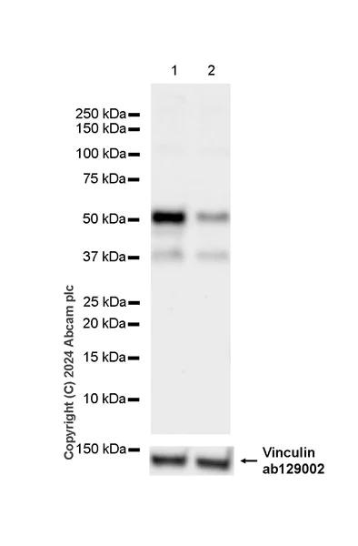 Western blot - Anti-XRCC4 antibody [EPR28958-63] - BSA and Azide free (AB317698)