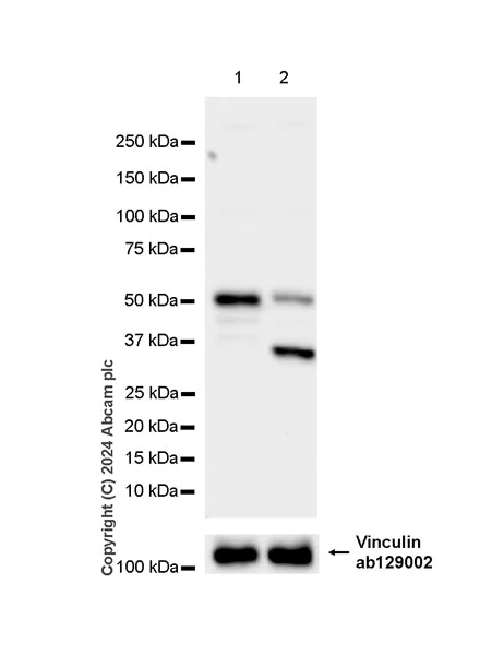 Western blot - Anti-XRCC4 antibody [EPR28958-63] - BSA and Azide free (AB317698)