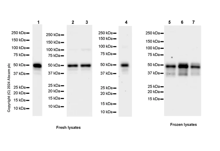 Western blot - Anti-XRCC4 antibody [EPR28958-63] - BSA and Azide free (AB317698)