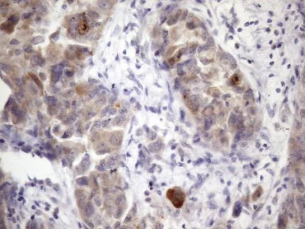 Immunohistochemistry (Formalin/PFA-fixed paraffin-embedded sections) - Anti-XRCC6BP1/KUB3 antibody [OTI5F3] (AB236425)