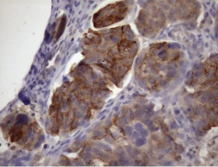 Immunohistochemistry (Formalin/PFA-fixed paraffin-embedded sections) - Anti-XRCC6BP1/KUB3 antibody [OTI5F3] (AB236425)