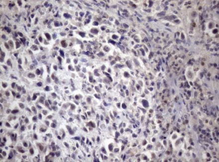 Immunohistochemistry (Formalin/PFA-fixed paraffin-embedded sections) - Anti-XRCC6BP1/KUB3 antibody [OTI5F3] (AB236425)