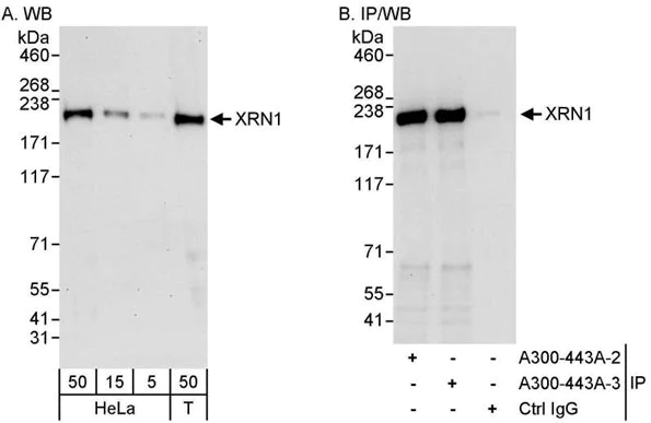 Immunoprecipitation - Anti-Xrn1 antibody (AB70259)