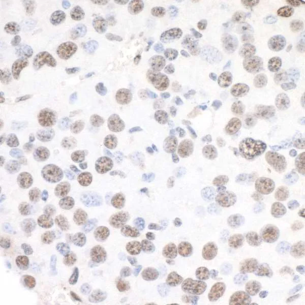 Immunohistochemistry (Formalin/PFA-fixed paraffin-embedded sections) - Anti-XRN2 antibody (AB72181)