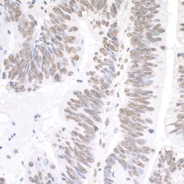 Immunohistochemistry (Formalin/PFA-fixed paraffin-embedded sections) - Anti-XRN2 antibody (AB72181)