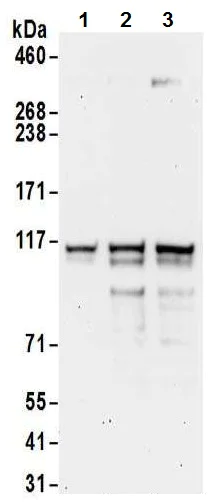 Western blot - Anti-XRN2 antibody (AB72181)