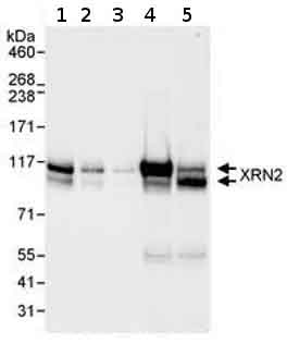 Western blot - Anti-XRN2 antibody (AB72284)