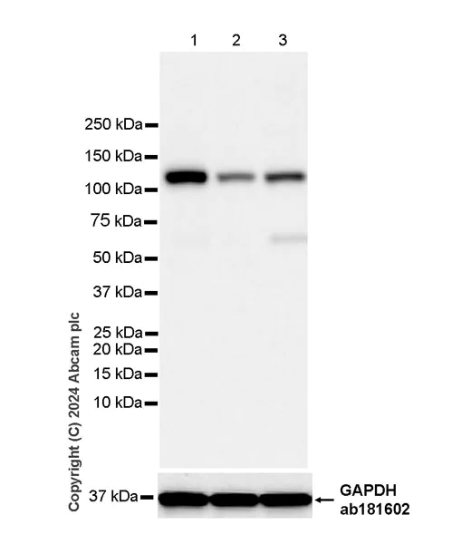 Western blot - Anti-XRN2 antibody [EPR28598-13] (AB318132)